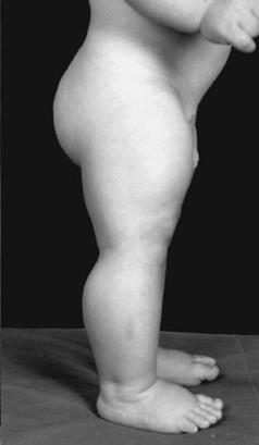 german baby myostatin 1 german baby myostatin 1